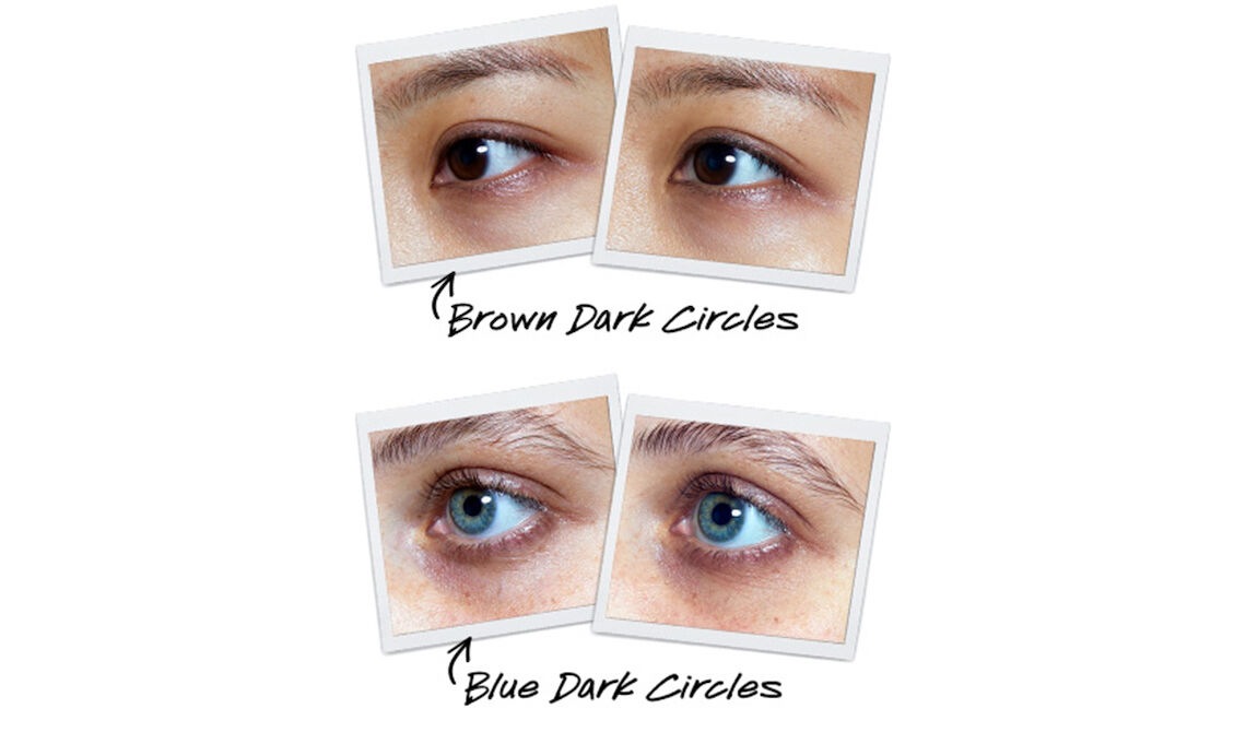 Vitamin c for dark circles deals